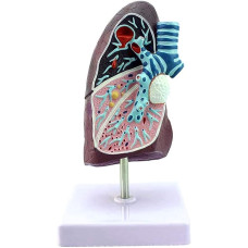 Pathological Model of the Lung