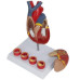 Human Heart and Thrombosis Model, 2 Parts