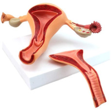 Internal Female Reproductive Organs, J-Type, 2 Parts