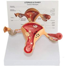 Pathological Model Female Reproductive System (detail)