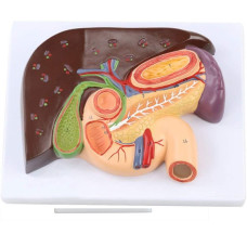 Liver with Gallbladder, Pancreas and Duodenum