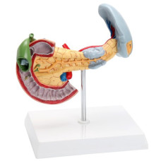 Pancreas, spleen, and duodenal lesion