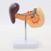 Pancreas, Duodenum and Spleen