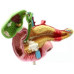 Pancreas, Duodenum and Gallbladder Pathological Model