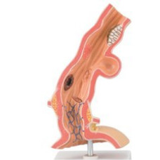 Pathological Model of Esophagus