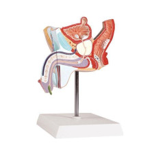 Pathological Model of the Male Urogenital System, 2 Parts