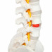 Flexible Vertebral Column with Open Sacrum and Femur Head